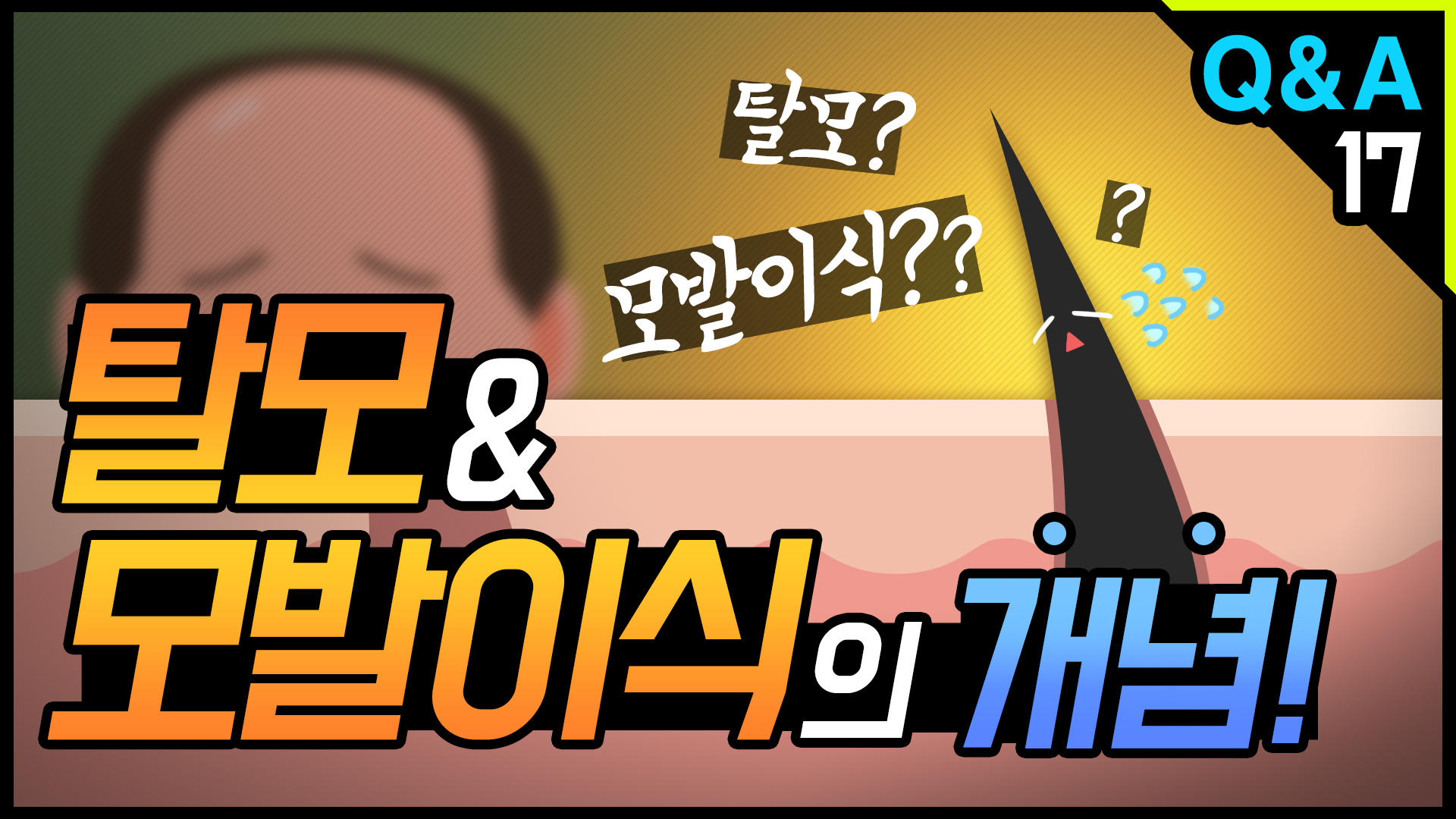 영상 썸네일